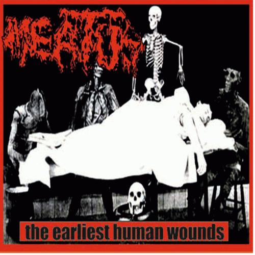 Meatus : The Earliest Human Wounds